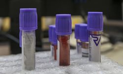 İngiltere’de denenen kan testiyle her üç kanserden ikisi tespit edildi